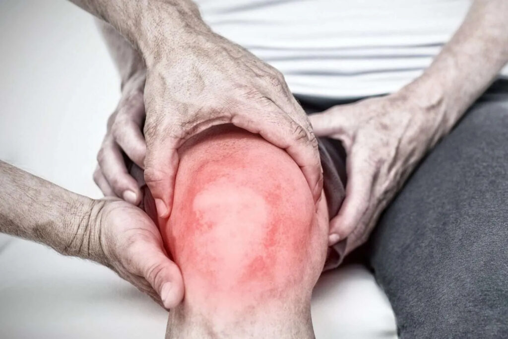 Artritis de rodilla